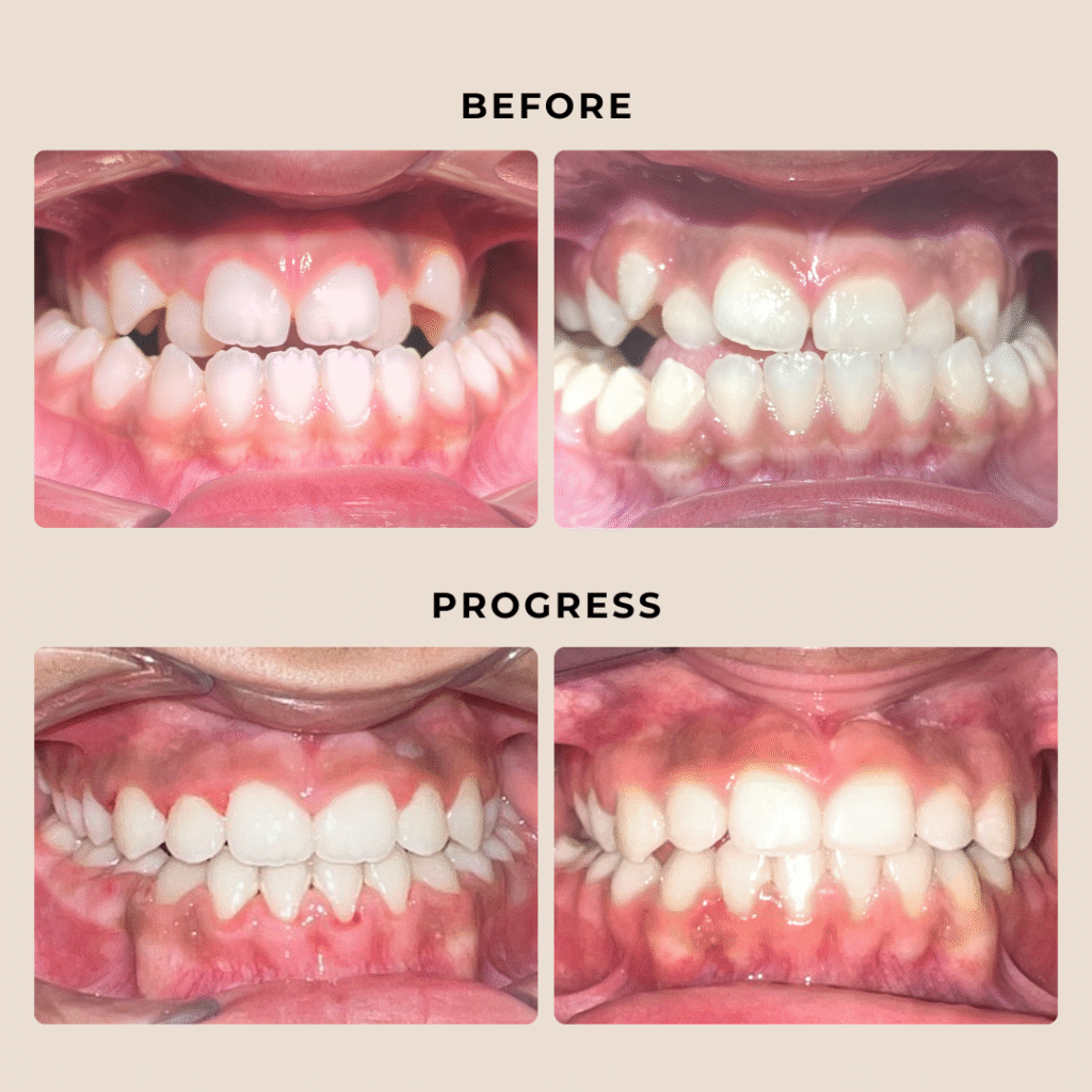 Thousand Smiles Orthodontics | Austin Orthodontist Near Me